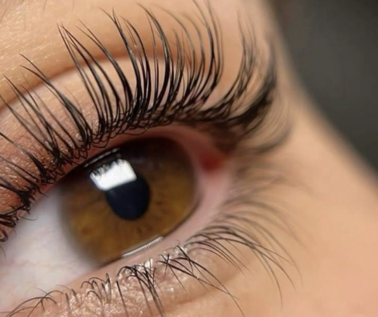 60 Min Fill (3 Week Classic Fill) treatment at J Skin Lab Hoboken