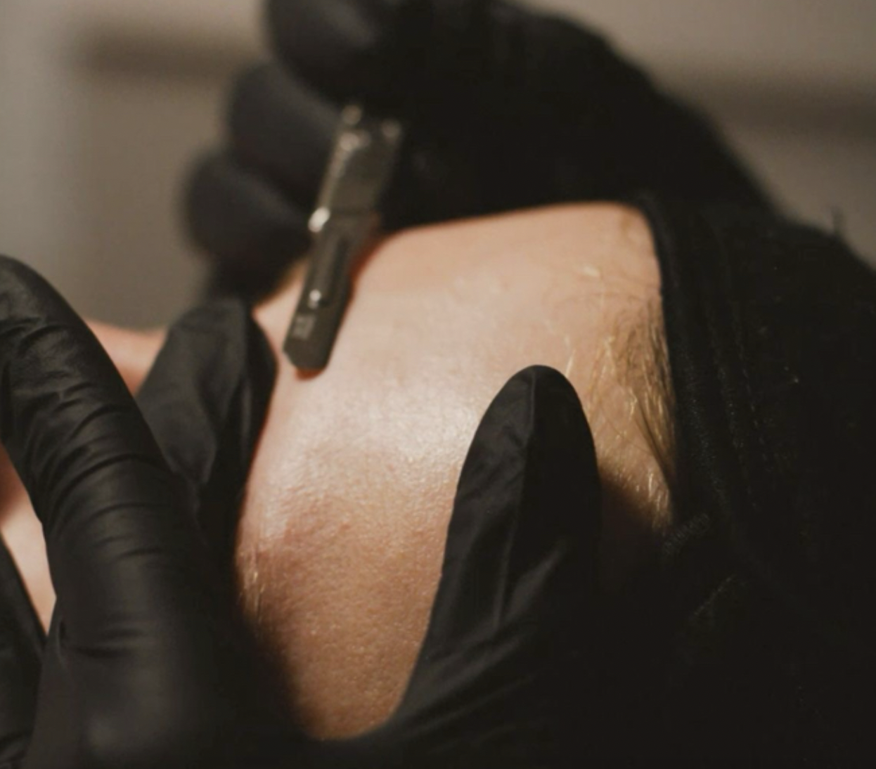 Dermaplane ADD-ON treatment at J Skin Lab Hoboken