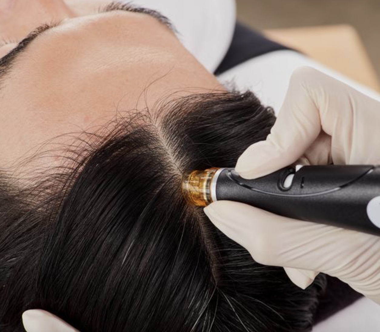 HydraFacial Hair Restoration treatment at J Skin Lab Hoboken