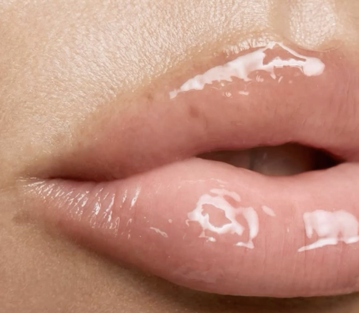 HydraFacial Lip Treatment ADD-ON treatment at J Skin Lab Hoboken